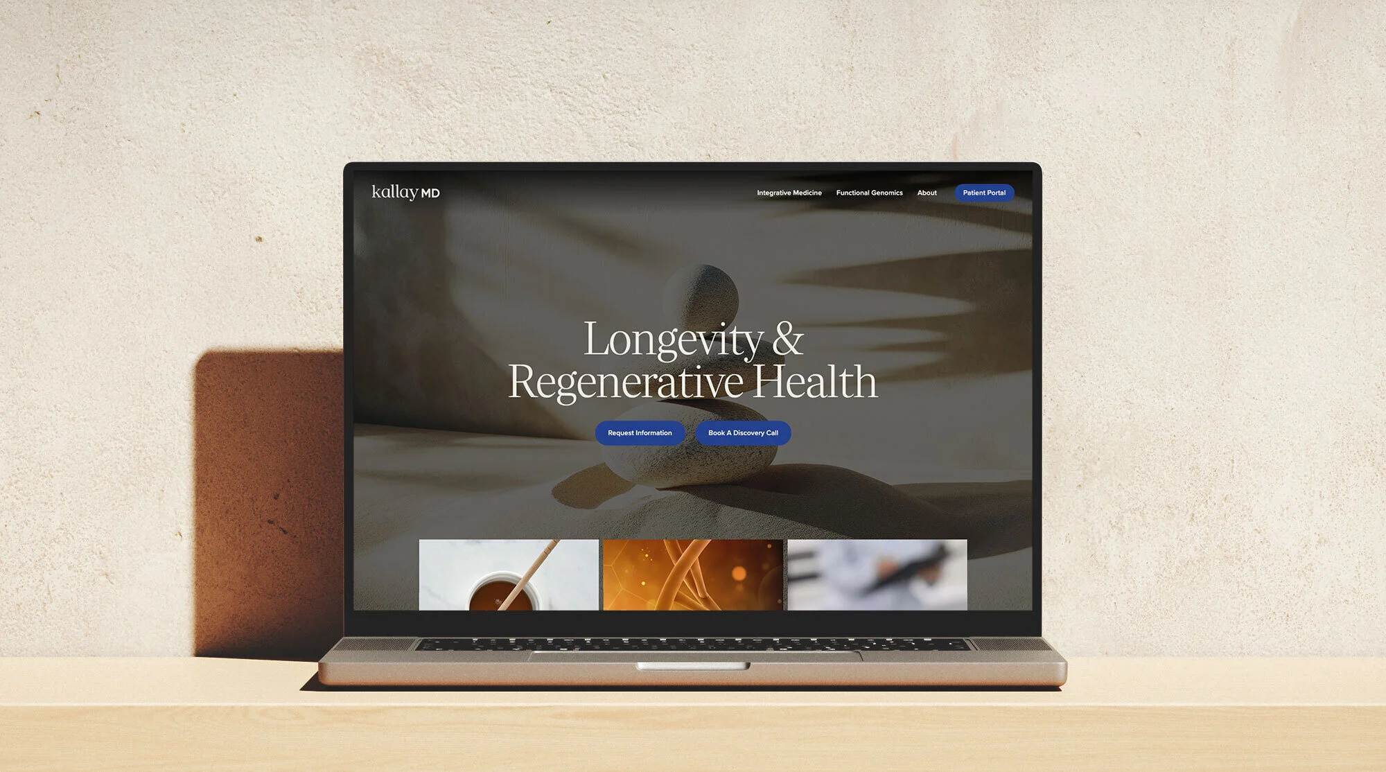The Kallay MD website on a laptop